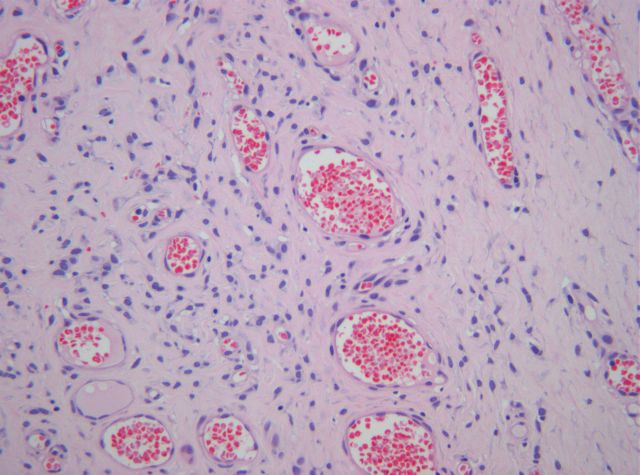 Hematoxilina-Eosina x200. - <div style=